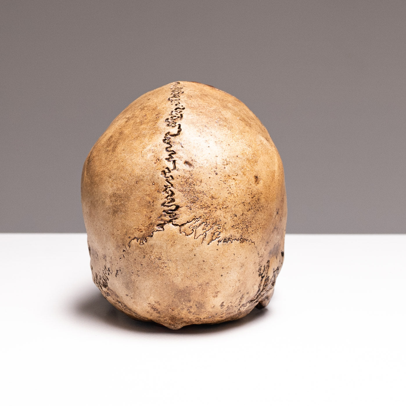 Human Skull - Bleached Bone - Gore
