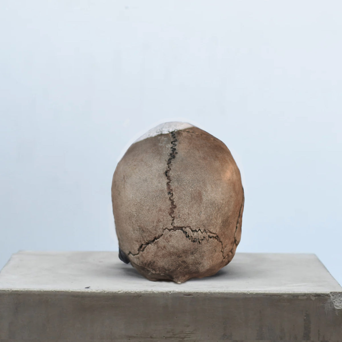 Human Skull - Marked